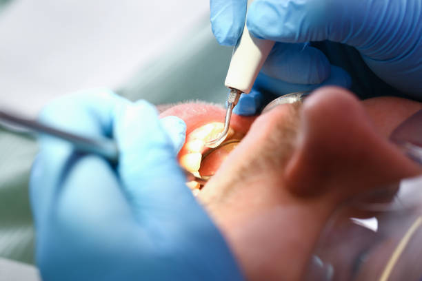 Best Broken or Chipped Tooth Repair in Warren Park, IN