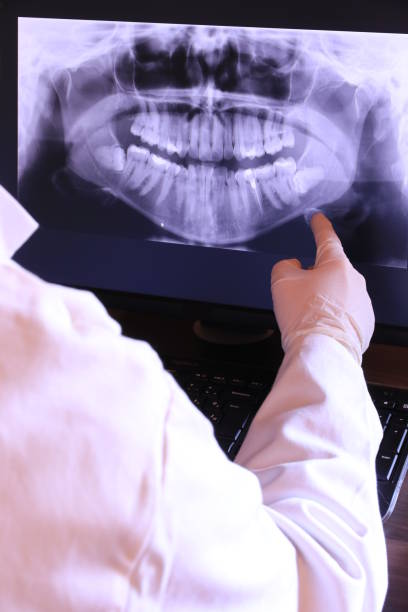 Best Emergency Dental Care for Sports Injuries in Warren Park, IN